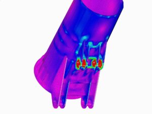 Analisi FEM di particolari costruttivi
